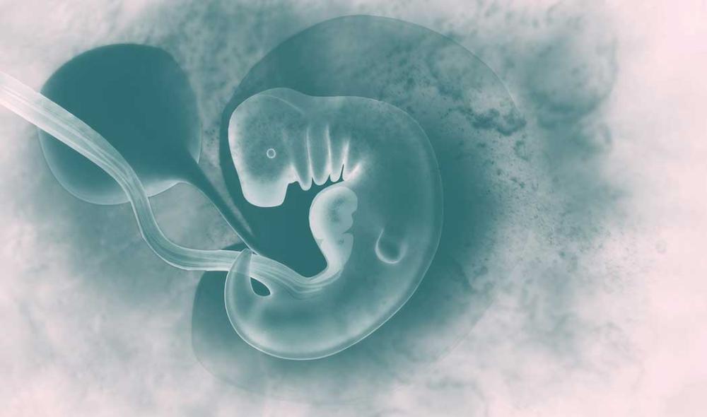 Malformaciones en Guatemala vinculadas a desnutrición